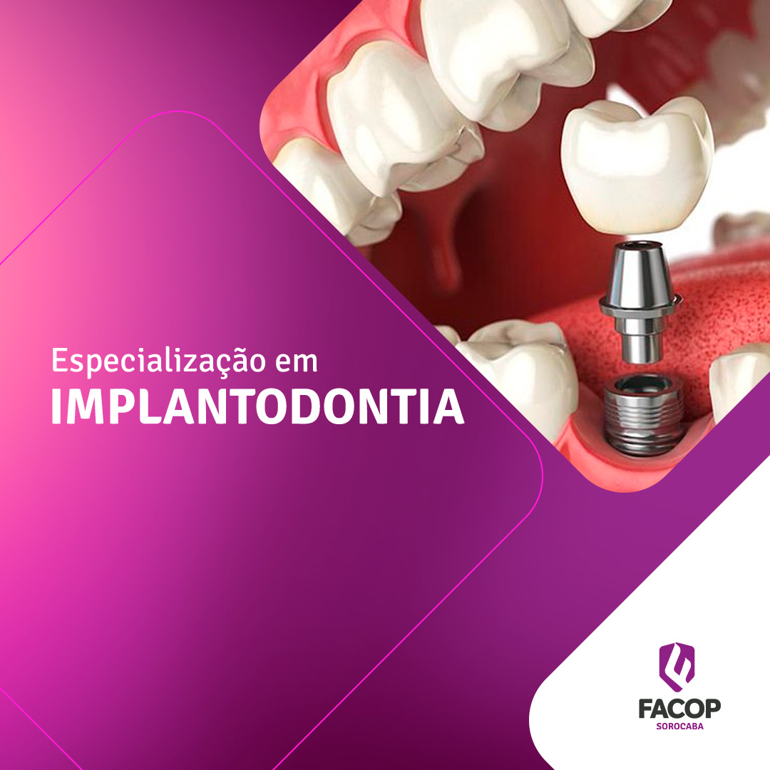 Fotomontagem na cor roxa com foto de um implante dental