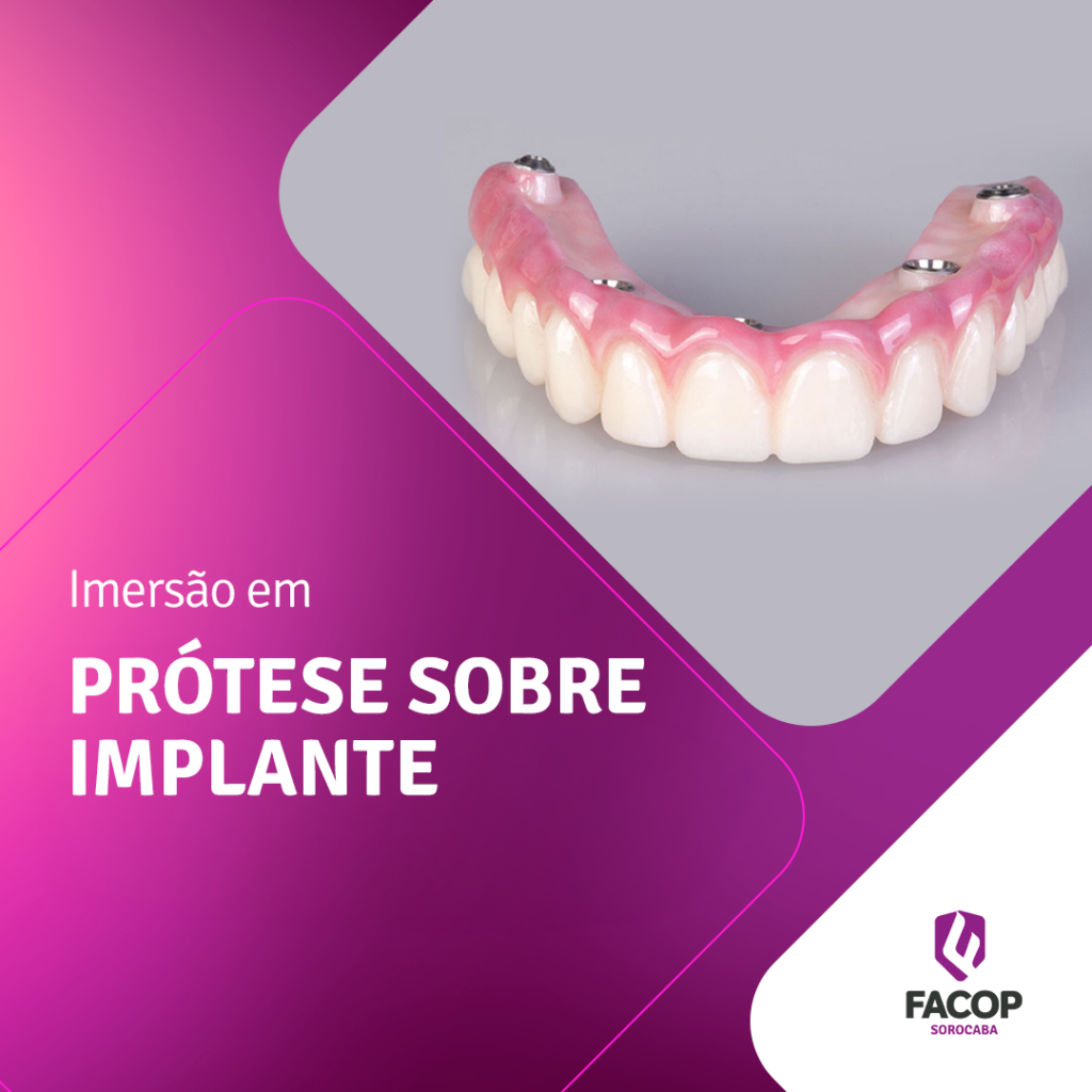 Prótese-sobre-implante